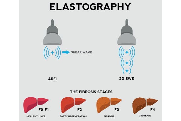 Médicos Especialistas - Gastroenterología