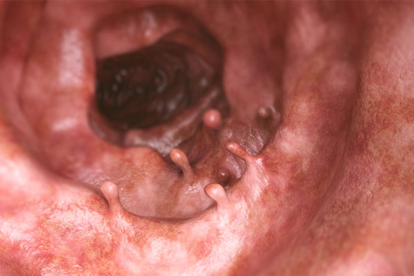 Médicos Especialistas - Gastroenterología