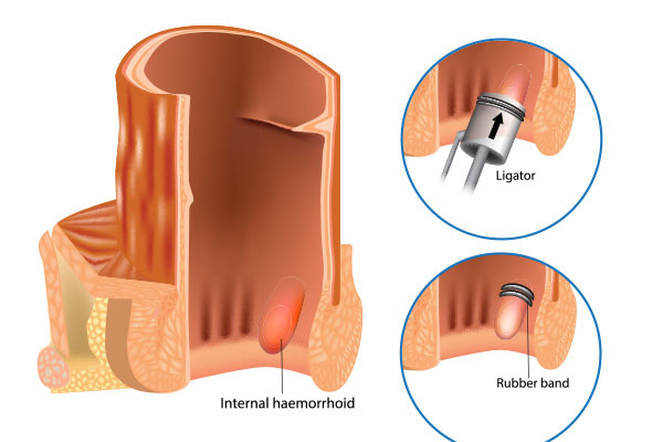 Médicos Especialistas - Gastroenterología